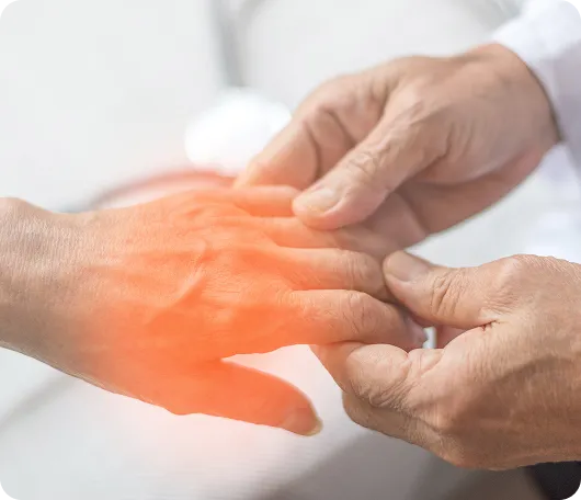 hand-arthritis-bg hand-arthritis-bg
