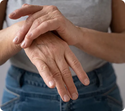 hand-arthritis hand-arthritis