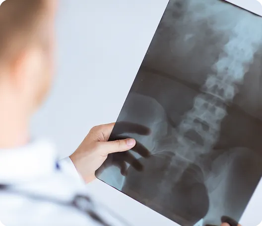 spine_xray_large spine_xray_large